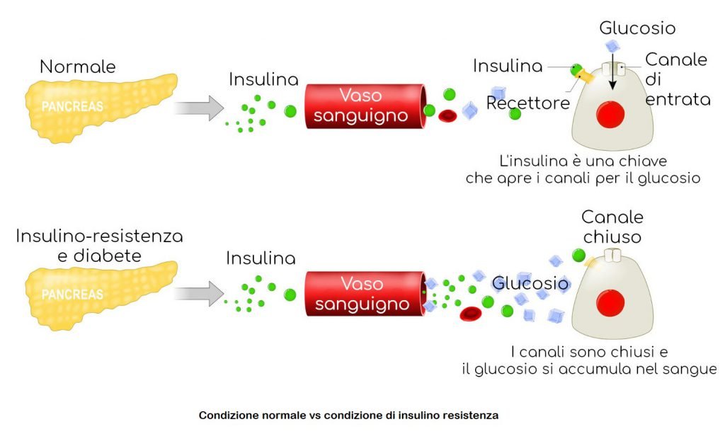 INSULINO RESISTENZA - STUDIO DOTT CARRARA - NUTRIZIONISTA E DIETE - CAVENAGO DI BRIANZA E RHO